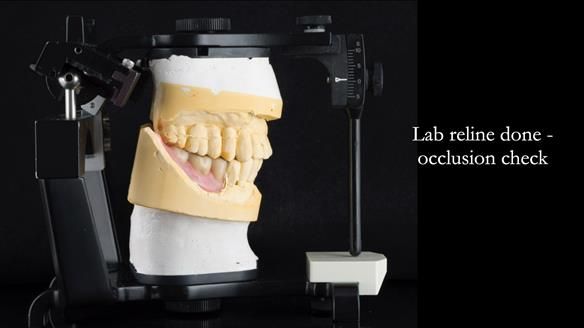 Ken – going downhill, first class