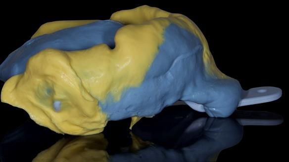 Newsletter 50 Special edition Complete Dentures FULL PROTOCOL