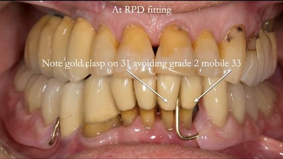 Ken – going downhill, first class