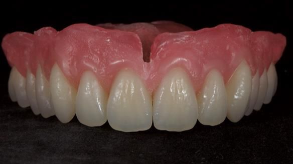 Newsletter 79 – Creating a wonderful smile and changing a life.