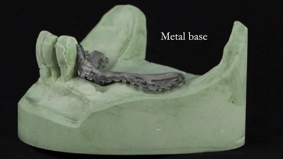 Ken – going downhill, first class