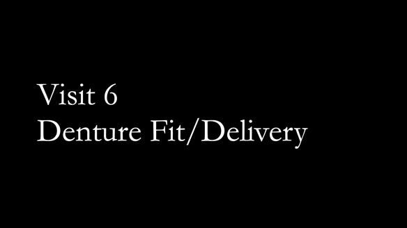 Newsletter 80 - Gordon’s dentures: the one case in 1,000 where my technique failed