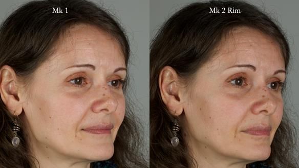 Newsletter 79 – Creating a wonderful smile and changing a life.