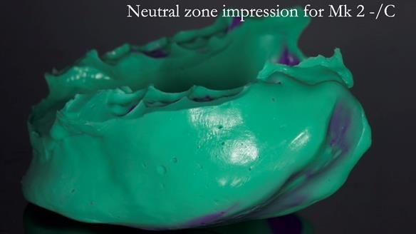 Replacing Madeline’s Complete denture FULL PROTOCOL