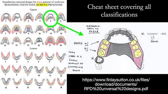 Finlay's Newsletter 60 Sylvia's upper Kennedy Class 2 Mod 1 metal based upper RPD