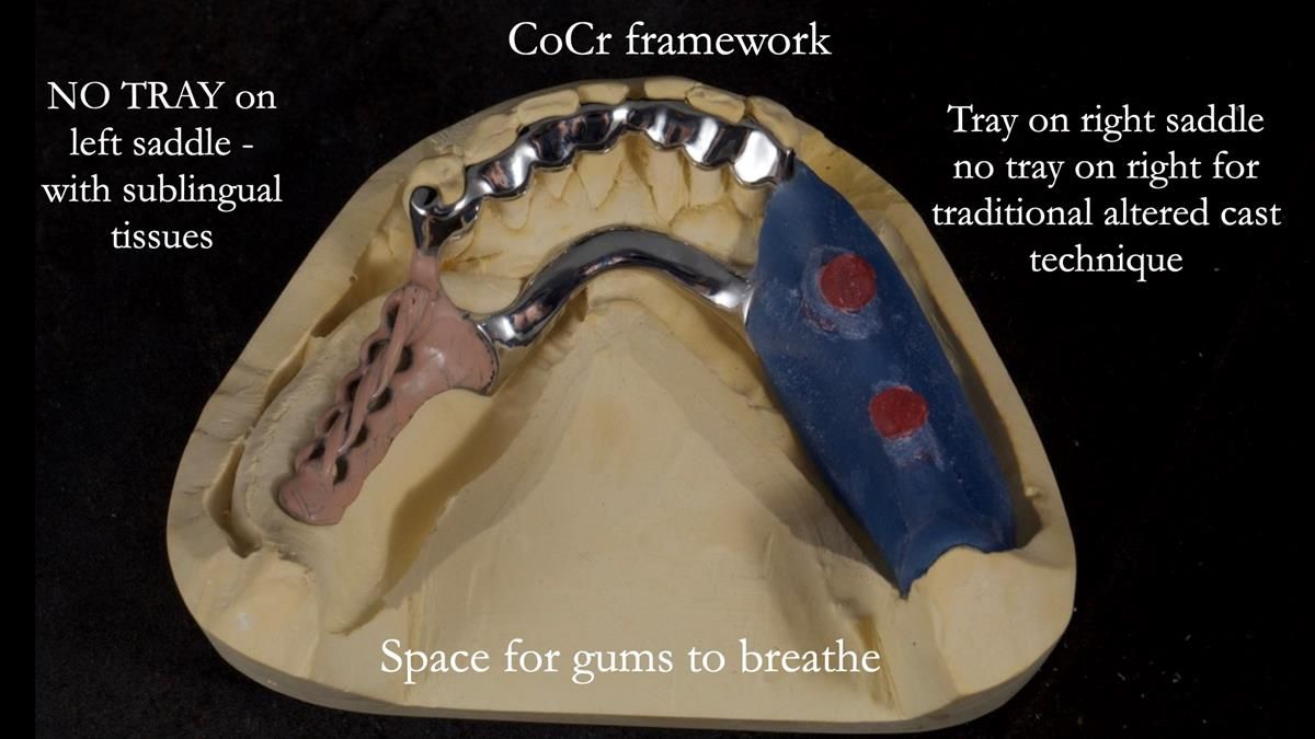 Newsletter 87 – Father Peter: A Partial Denture that needed Minor Miracle