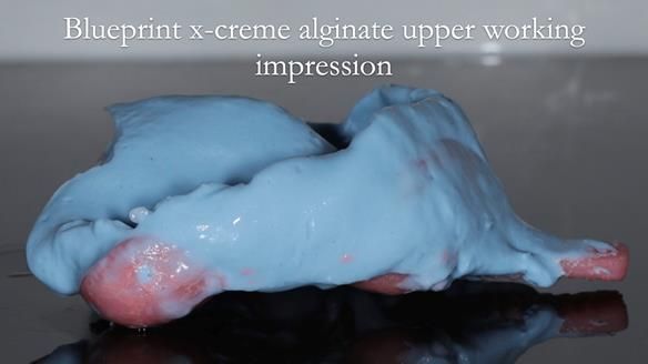 Finlay's Newsletter 60 Sylvia's upper Kennedy Class 2 Mod 1 metal based upper RPD