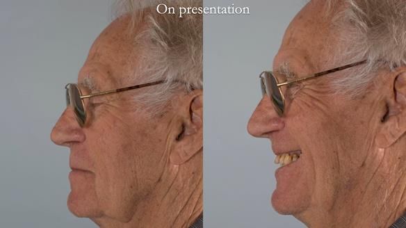 Ken – going downhill, first class