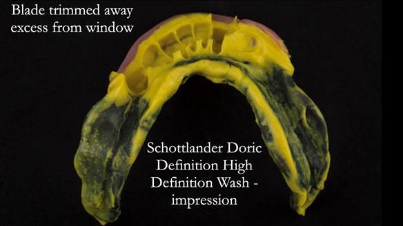 Ken – going downhill, first class