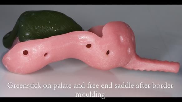 Finlay's Newsletter 60 Sylvia's upper Kennedy Class 2 Mod 1 metal based upper RPD