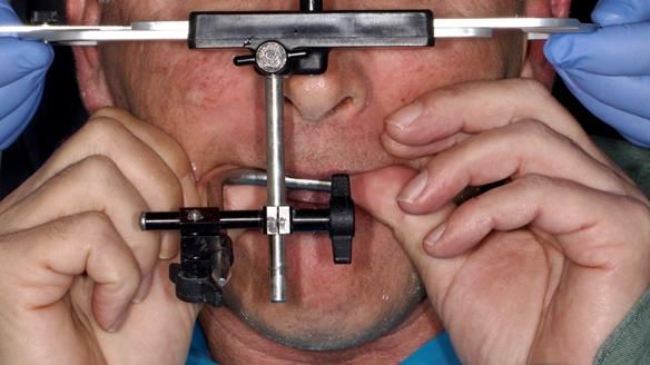 Newsletter 86 Peter the Architect — precision removable partial dentures case study
