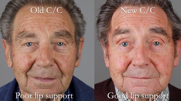 Newsletter 50 Special edition Complete Dentures FULL PROTOCOL
