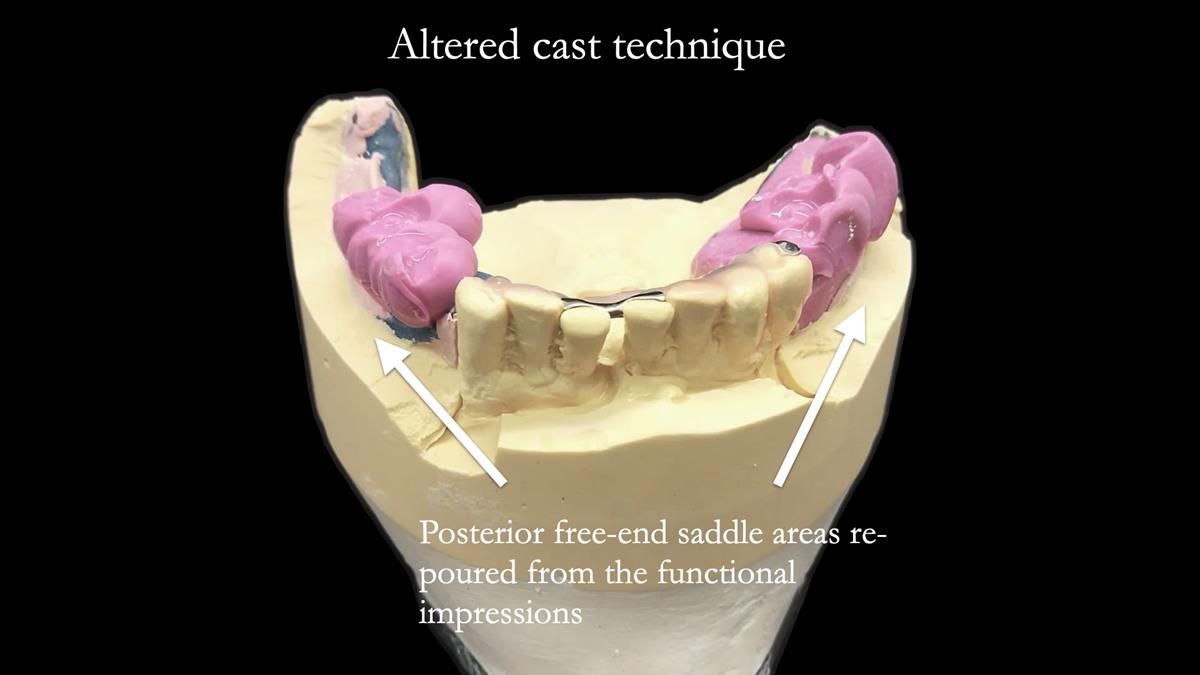 Newsletter 87 – Father Peter: A Partial Denture that needed Minor Miracle