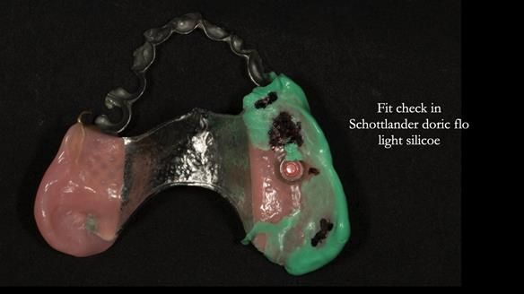 Ken – going downhill, first class