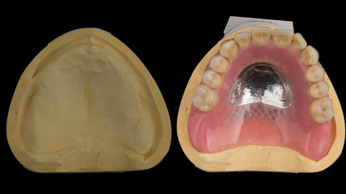 Newsletter 87 – Father Peter: A Partial Denture that needed Minor Miracle