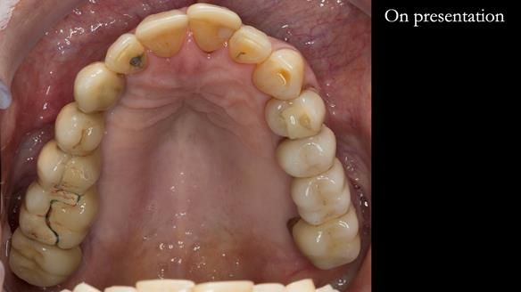 Ken – going downhill, first class