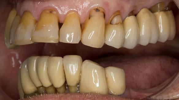 Ken – going downhill, first class