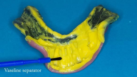 Ken – going downhill, first class