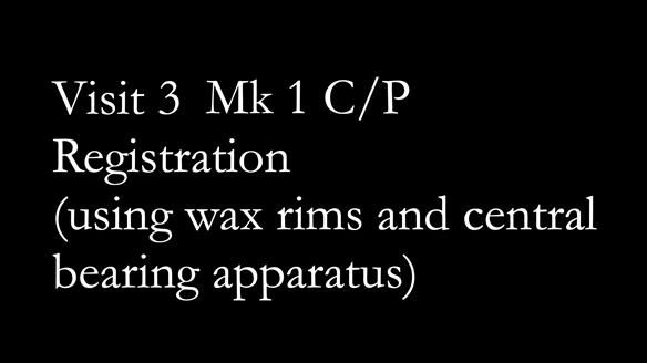 Newsletter 52 Managing Jo’s failing dentition with extractions and Mk 1/Mk 2 complete upper dentures and lower partial dentures FULL PROTOCOL
