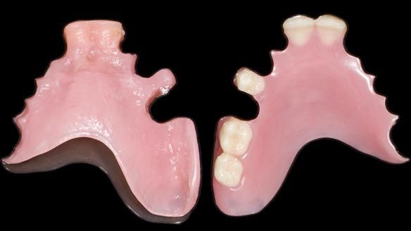 Newsletter 79 – Creating a wonderful smile and changing a life.