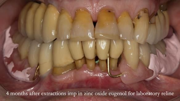 Ken – going downhill, first class