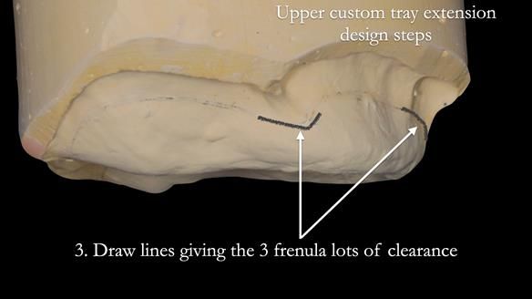 Newsletter 50 Special edition Complete Dentures FULL PROTOCOL