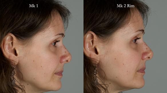 Newsletter 79 – Creating a wonderful smile and changing a life.