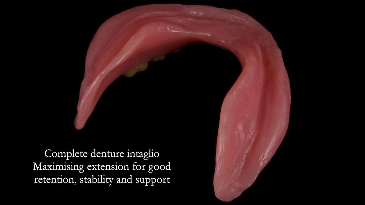 Fin’s Newsletter 88 — Complete dentures - full protocol… he rearranged his own teeth!