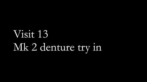 Replacing Madeline’s Complete denture FULL PROTOCOL