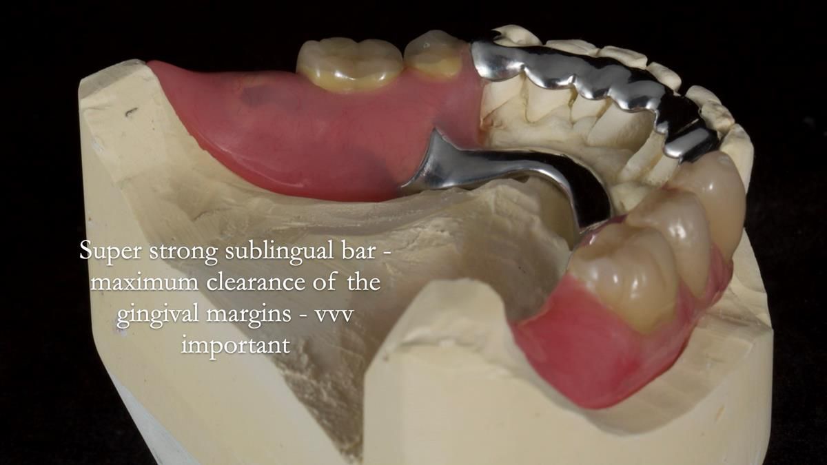 Newsletter 87 – Father Peter: A Partial Denture that needed Minor Miracle