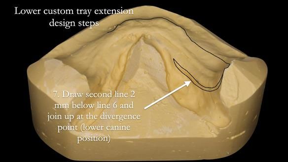 Newsletter 50 Special edition Complete Dentures FULL PROTOCOL