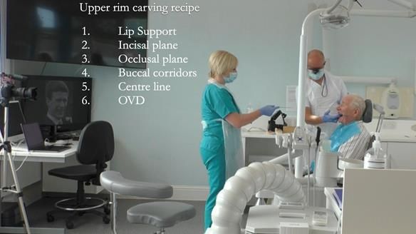 Complete denture Class II div 2 deep overbite Newsletter 39
