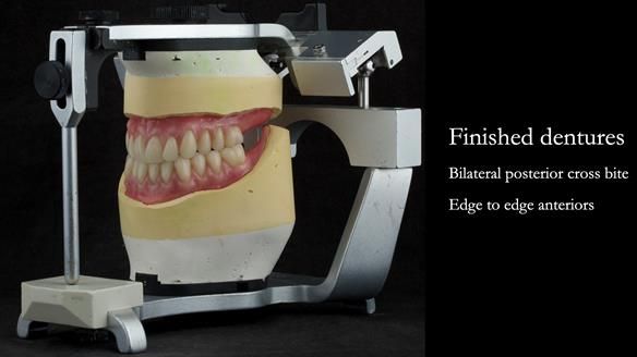 Finished dentures