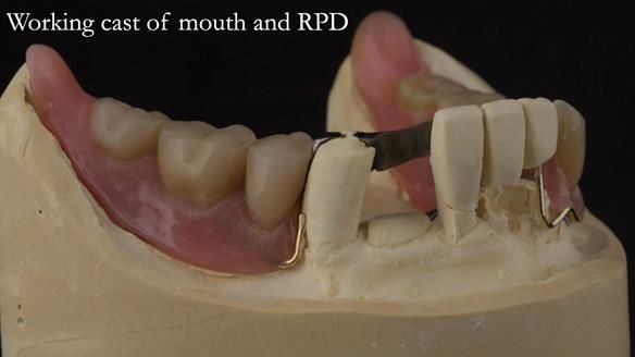 Ken – going downhill, first class