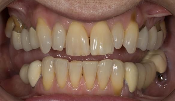 Figure 3 Pre - treatment.