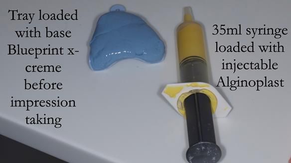 Solving Sue's failed implants with metal based RPD - full protocol Newsletter 43