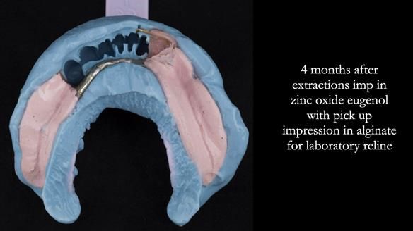 Ken – going downhill, first class