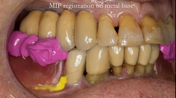 Ken – going downhill, first class