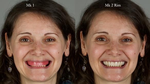 Newsletter 79 – Creating a wonderful smile and changing a life.