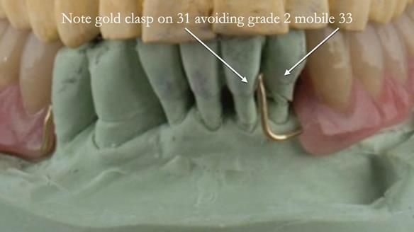 Ken – going downhill, first class