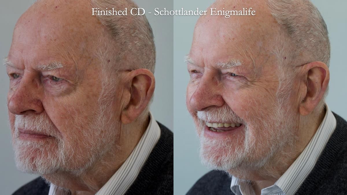 Newsletter 87 – Father Peter: A Partial Denture that needed Minor Miracle