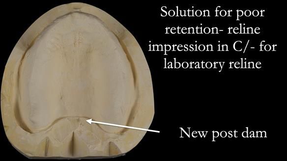 Newsletter 53 showing the making and fitting of ultra life-like dentures for Valena