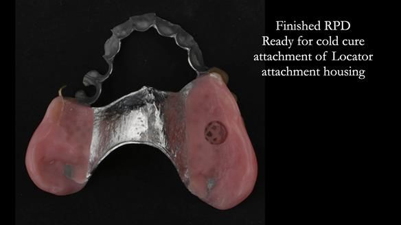 Ken – going downhill, first class