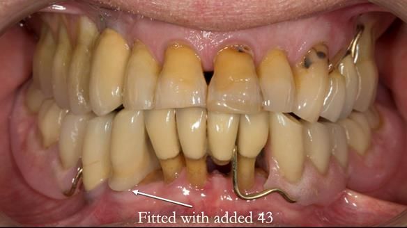 Ken – going downhill, first class