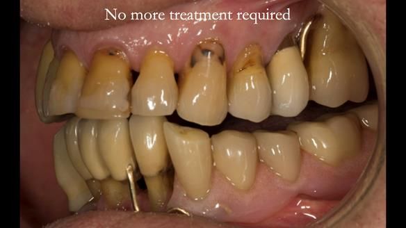 Ken – going downhill, first class