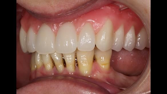 Newsletter 79 – Creating a wonderful smile and changing a life.