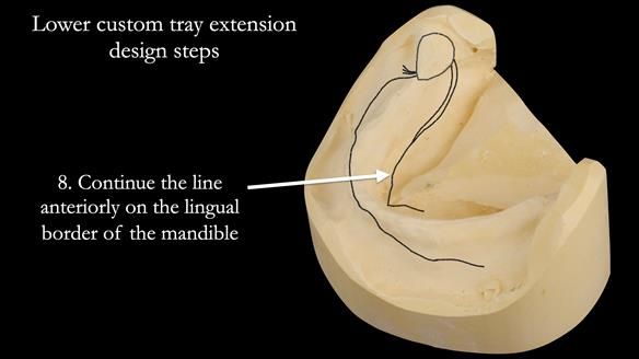 Newsletter 50 Special edition Complete Dentures FULL PROTOCOL