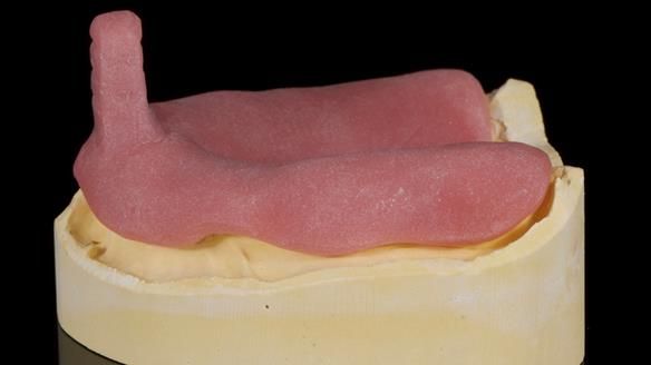 Newsletter 79 – Creating a wonderful smile and changing a life.