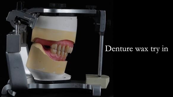 Newsletter 50 Special edition Complete Dentures FULL PROTOCOL