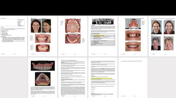 Newsletter 79 – Creating a wonderful smile and changing a life.
